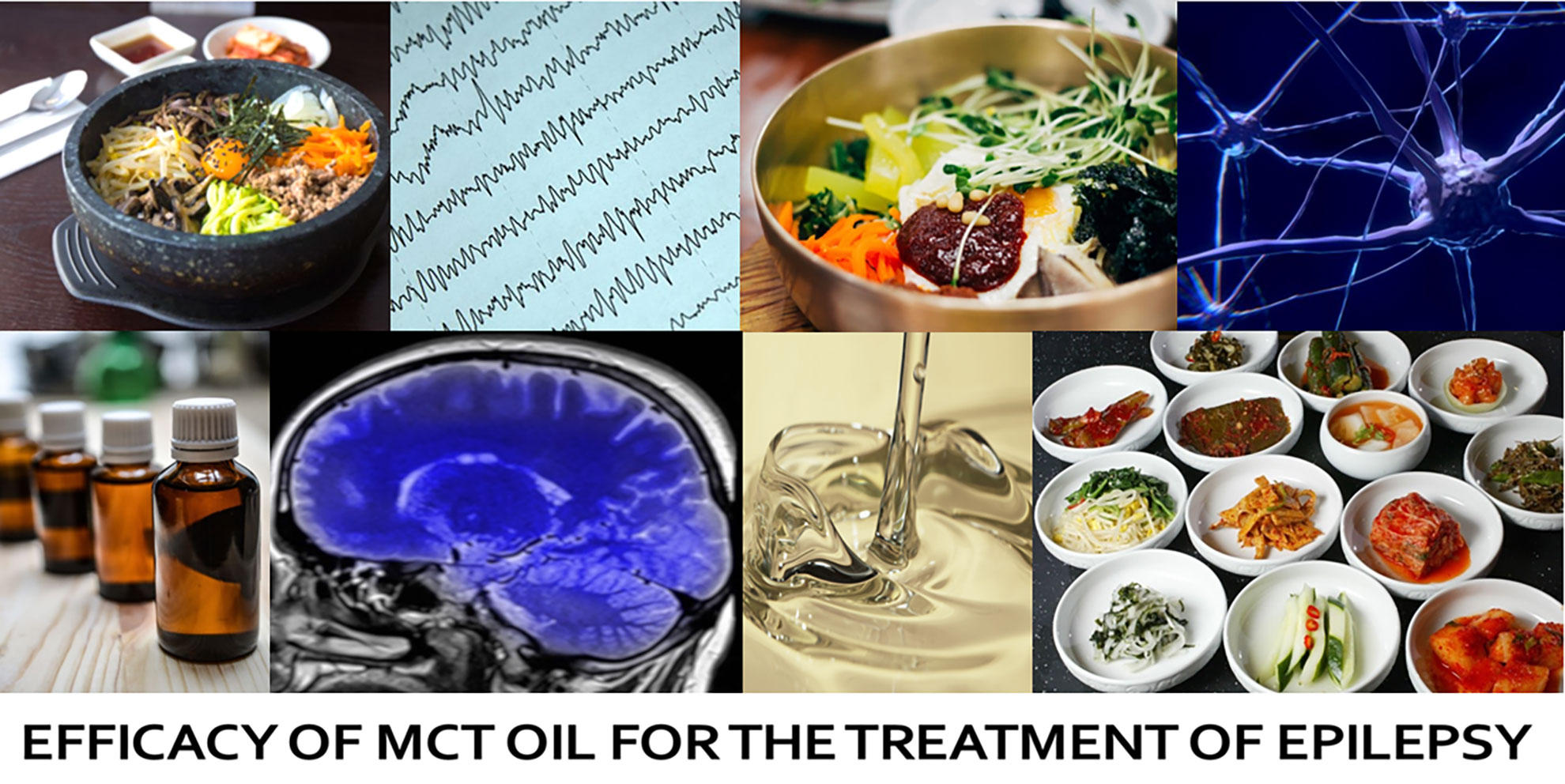 A collage of pictures showing relevant images including Medium Chain Triglycerides (MCT) oil, brain scan and food linking to this project. 